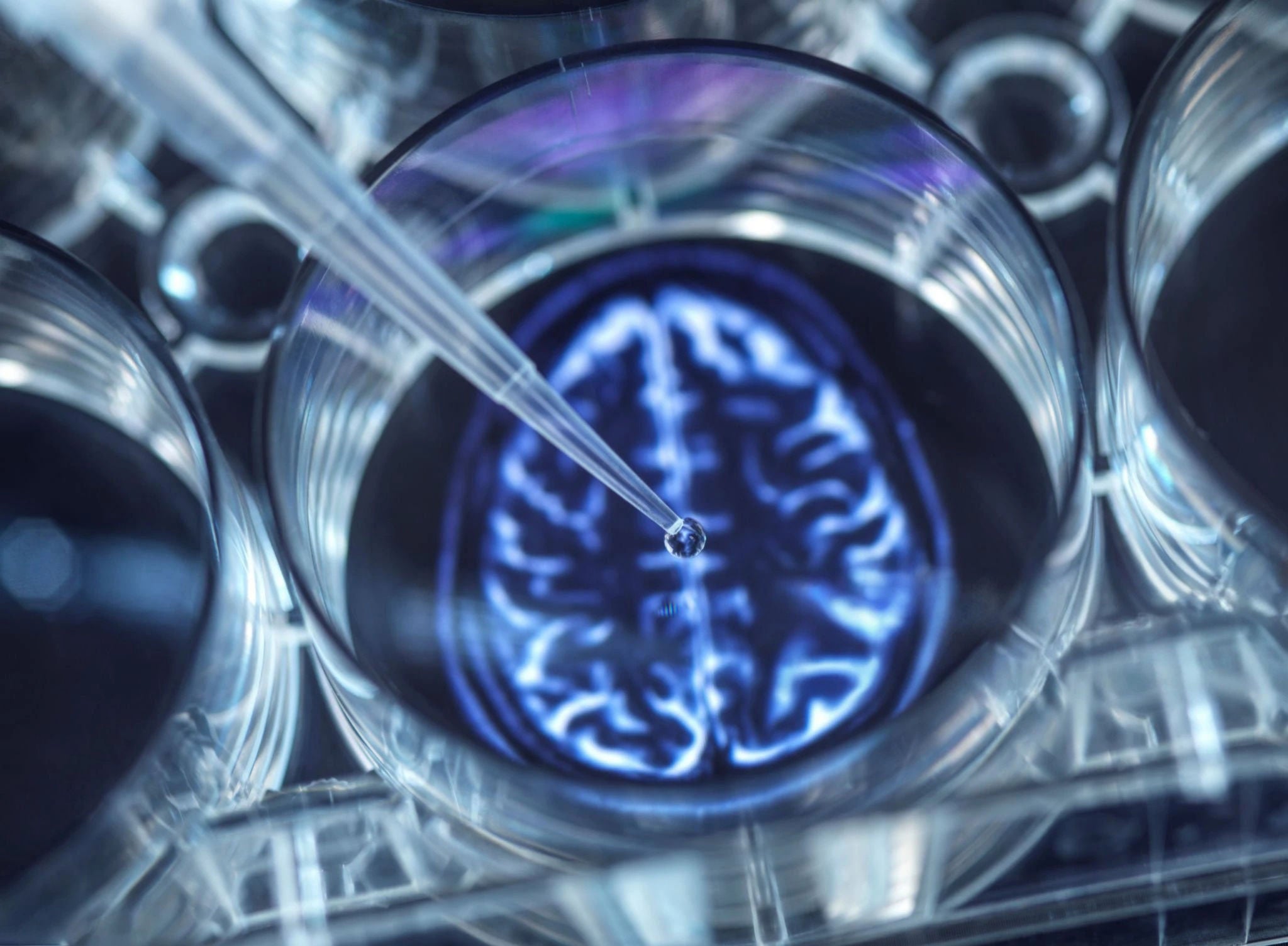 An MRI scan of a brain is displayed in a futuristic, high-tech environment with neon blue lighting, highlighting medical advancements.